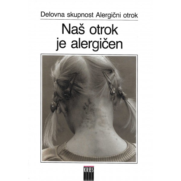 Naš otrok je alergičen